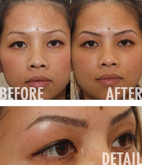 29+ Laser Eyebrow Tattoo Removal Before And After Pics | Eyebrow Ideas