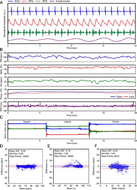 Comprehensive Pregnancy Monitoring With A Network Of Wireless Soft