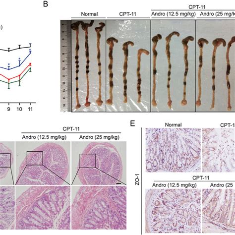 Andrographolide Prevented Intestinal Mucositis Caused By Cpt 11 In