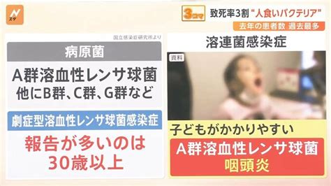 致死率3割“人食いバクテリア”去年の患者数が過去最多、感染経路は傷口から予防策は？【nスタ解説】 Tbs News Dig 2ページ