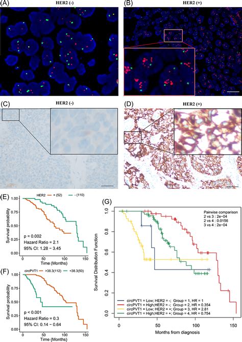 Circpvt Proliferation Prognosis Of Bladder Cancer Pgpm