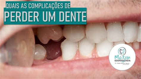 Perdi Um Dente E Agora Youtube