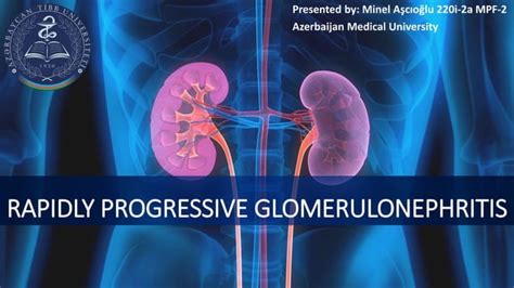 Rapidly Progressive Glomerulonephritis Diagnosis And Treatment Ppt