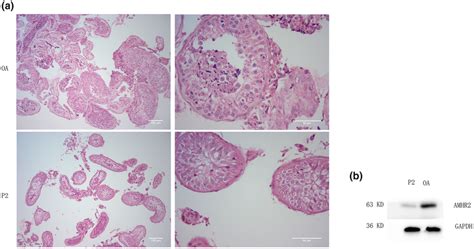 Testicular Histopathology And Western Blotting Results Of P2 And Oa