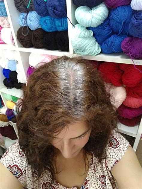 La Rebelión De Las Canas Hace Cinco Meses Dejé De Tapar Mis Canas Y Quiero Descubrir Mi Pelo