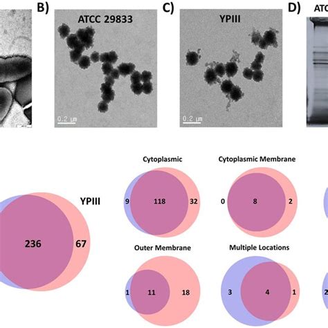 Y Pseudotuberculosis Secretes Mvs And The Proteomes Differ Based On Download Scientific