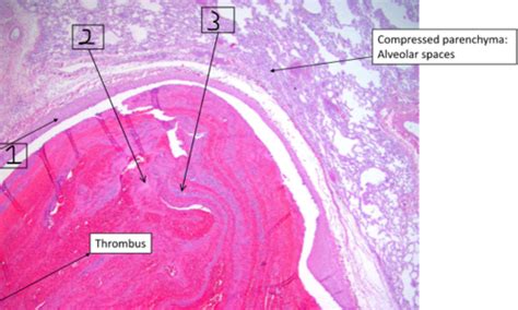 Histopathology Lab Flashcards Quizlet