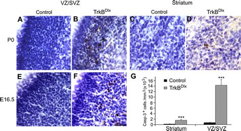 striatal neuronal loss  due  increased apoptosis   striatal