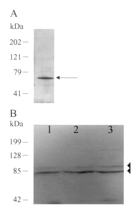 Western Blot Of CAT1 In HUVEC And HPMEC Cell Lysates From One HUVEC