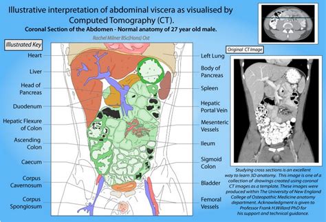 CT Abdominal Viscera Illustrative Interpretation Of Abdominal Viscera