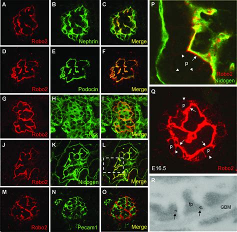 Robo2 Is Expressed And Localized To The Basal Cell Surface Of Podocytes