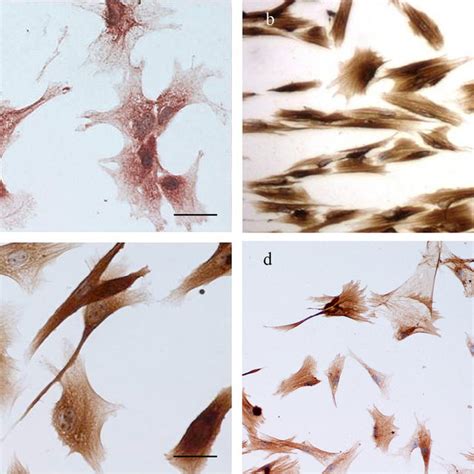 Immunocytochemical Characterisation Of Myoepithelial Cells Isolated By