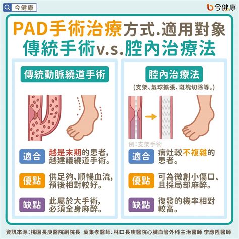 下肢傷口難癒合？糖友注意！除了糖尿病足，你也該認識「周邊動脈疾病pad」 今健康