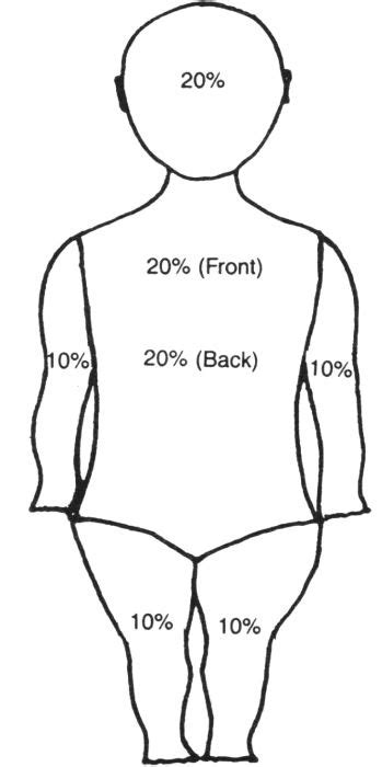 Pediatric Rule Of Nines Chart