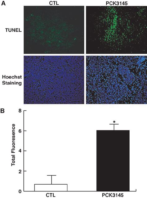 Effect Of Pck On Dna Fragmentation Of Mat Ly Lu Pthrp Cells In