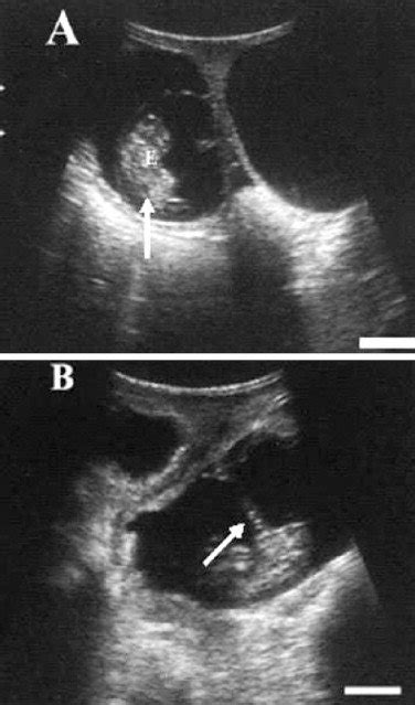 Ultrasound Images Of Goat Embryo At Day 30 A And 35 B Of Gestation