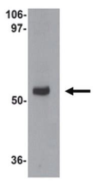 Anti Myozap Antibody From Rabbit Purified By Affinity Chromatography