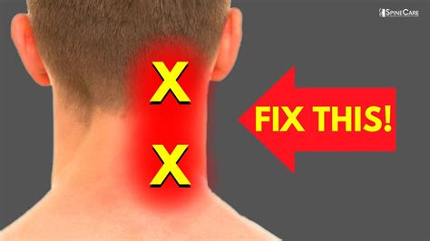 What Does A Neck Pain Mean At Jennifer Samantha Blog