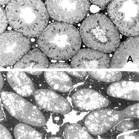 Representative Light Micrographs Of Testicular Sections From Adult