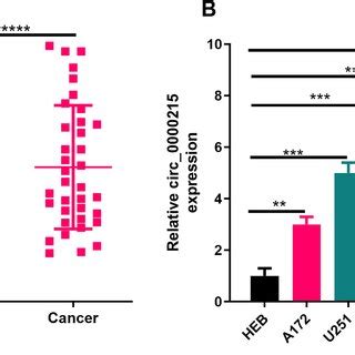 The Expression Of Circ 0000215 In Glioma Tissues And Cell Lines A