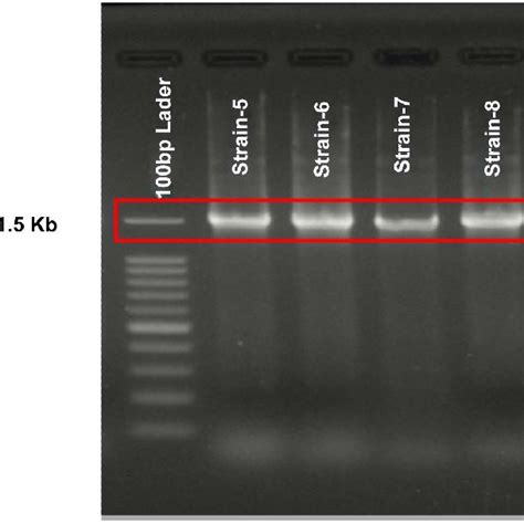 Gel Electrophoresis Of The Pcr Product Of Dna For 16s Rdna Lane1 Download Scientific Diagram