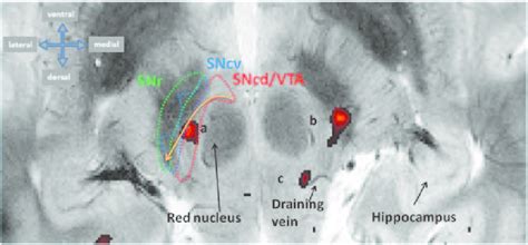 3 Very High Field Functional And Structural Imaging Of The Sn Vta At 7 Download Scientific