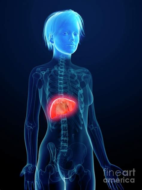 Illustration Of An Inflamed Liver Photograph By Sebastian Kaulitzki