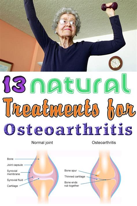 13 Natural Treatments For Osteoarthritis Exercise