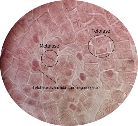 Pr Ctica De Mitosis En Ra Ces De Cebolla P Gina Web De Mferminprofe