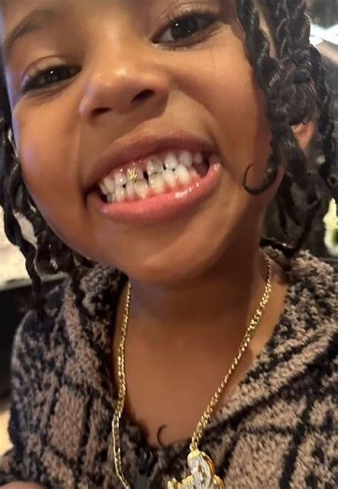 Kim Kardashian S Daughter North West Unveils Dramatic Teeth