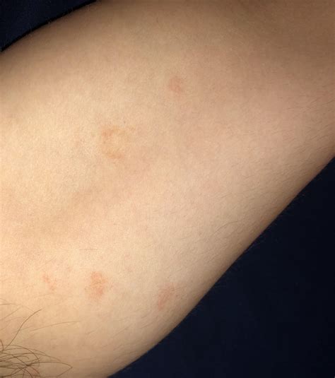 Strange skin spots? : r/Dermatology