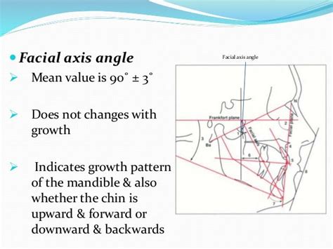 Cephalometrics Hard And Soft Tissue In Detail