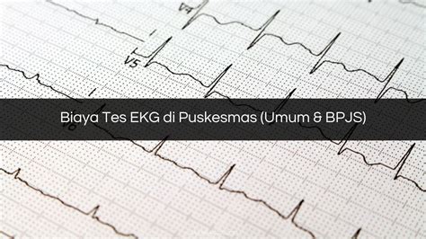 Biaya Tes EKG Di Puskesmas Umum BPJS 2023 Harga Biaya