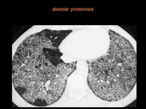 28 Dr Ahmed Esawy Imaging Oral Board Of Chest Imaging Variety Part