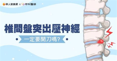 椎間盤突出壓神經，一定要開刀嗎？復健醫：下背、小腿痠麻痛「針」有效 華人健康網 專業即時優質的健康新聞及資訊分享平台業即時優質的健康