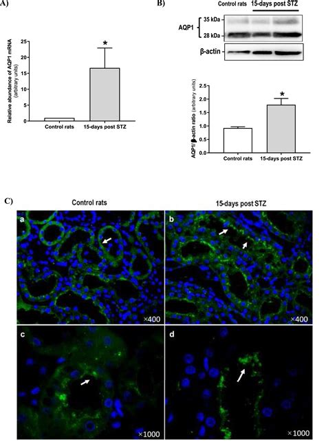 AQP1 Expression In The Proximal Tubule Of Diabetic Rat Kidney Heliyon