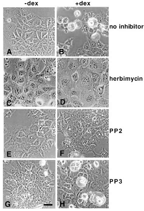 Figure From Src Induces Morphological Changes In A Cells That