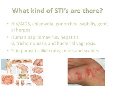 Sexually Transmitted Diseases