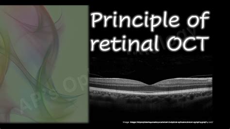 Oct Principle Of Retinal Oct Youtube