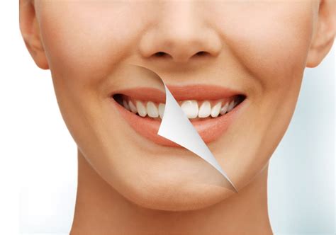 Blanqueamiento Dental Barcelona Ortoimplants Premium
