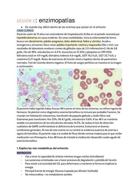 SESIÓN 11 Hemoglobina y metabolismo del GR hyakkimaru kun uDocz