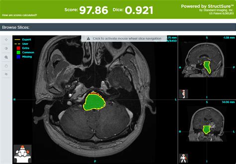 Proknow Contour Activity Hieu Tran M S R T T