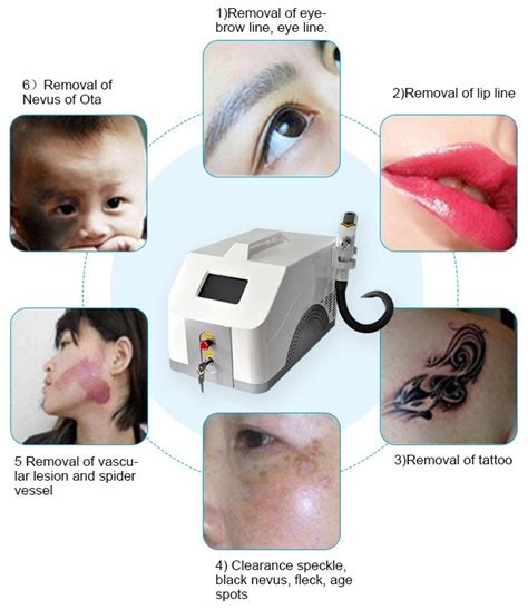 Picolaser Q Switched Nd Yag Laser Tattoo Remove Machine Freckle