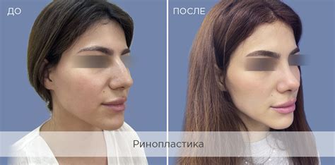 Пластическая хирургия — услуги клиники «Институт пластической хирургии ...