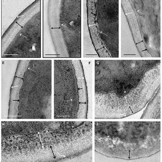 Changes In The Ultrastructure Of Cell Walls Of C Albicans At The