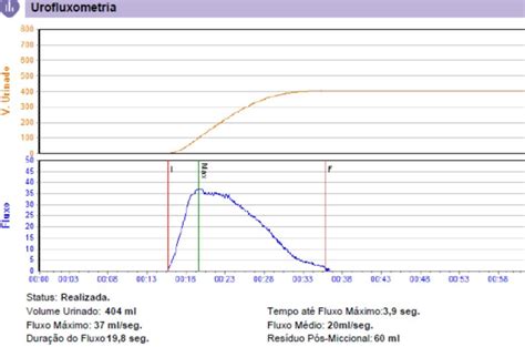 Estudo Urodin Mico E Urofluxometria Uromed Manaus