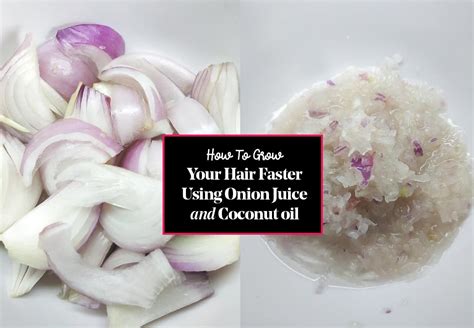 DIY ONION JUICE HAIR GROWTH RECIPE - Priezor.com