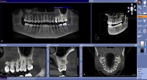 Dental X Rays Understanding The Different Types Clermont Dentistry