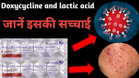 Doxycycline And Lactic Acid Bacillus Capsule Use In Hindi Doxt Sl Capsule Benifits Youtube