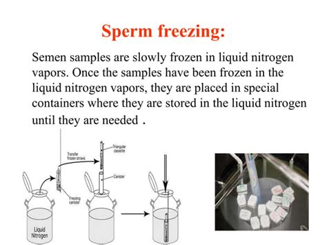 Sperm Assesmenandpreparationandcryopreservationppt